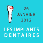 Les Implants Dentaires